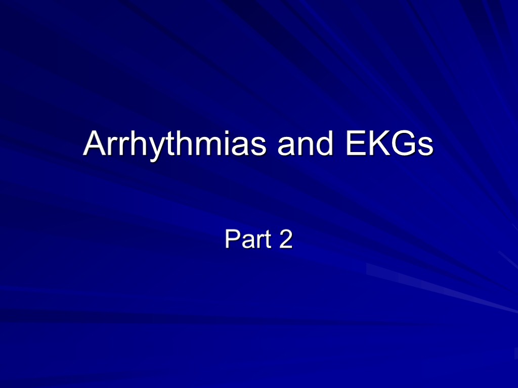 Arrhythmias and EKGs Part 2